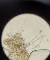 Peronospora